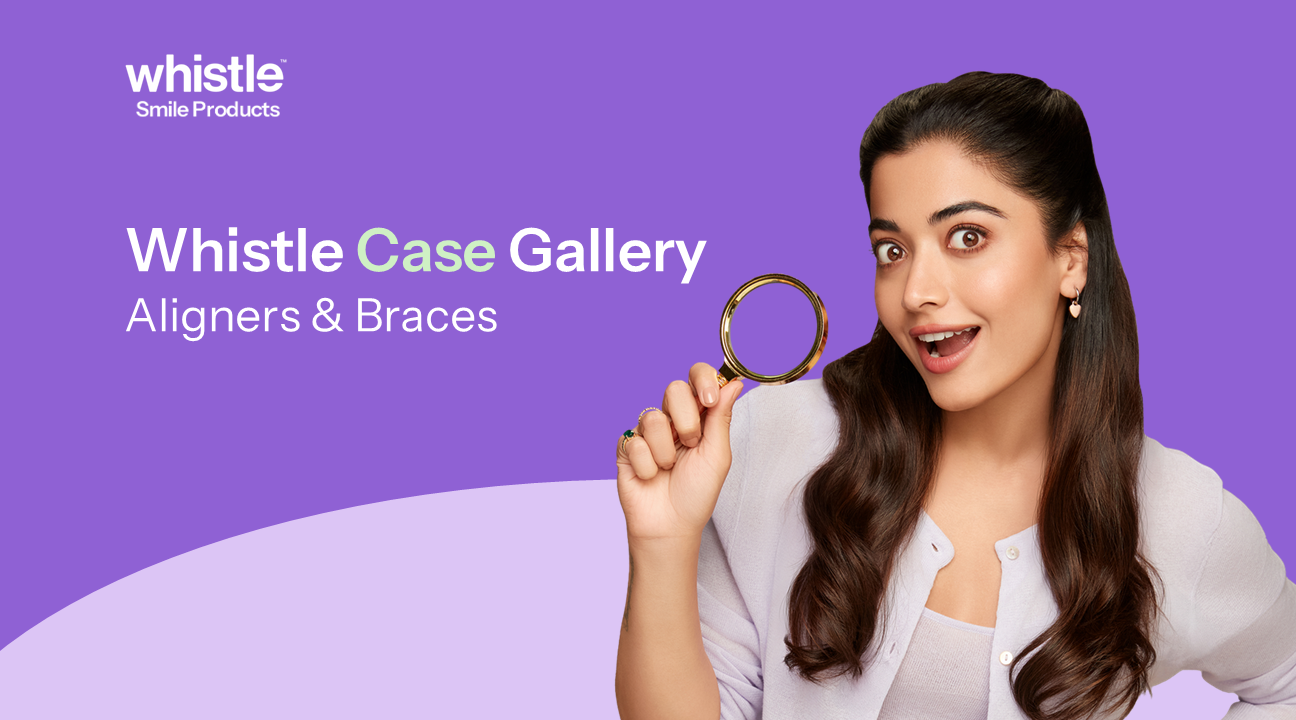 Whistle Case Gallery