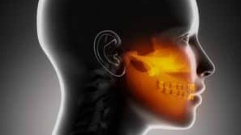 Management of  TEMPOROMANDIBULAR JOINT DISORDERS (TMDS) 