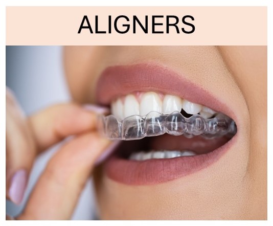 Aligner 